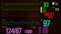 Atrial Flutter and Vital Signs