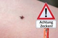 Attention ticks Warning sign with a tick on the arm in german Royalty Free Stock Photo