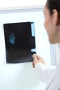Attractive young female doctor examining x-ray results Royalty Free Stock Photo