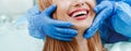 Attractive young woman with smiling with natural white teeth in dental clinic. Hands doctor dentist with medical tools. Healthy