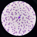 Atypical lympho cyte in red blood cell background