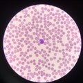 Atypical lymphocyte on red blood cells background
