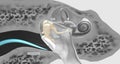 The auditory ossicles amplify all sound vibrations moving into the inner ear