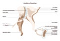 Auditory ossicles. Bony malleus, incus and stapes. Middle ear tympanic