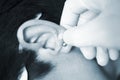 Auriculartherapy ear seed treatment