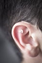 Auriculartherapy ear seed treatment