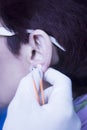 Auriculartherapy ear seed treatment