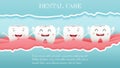 Teeth cute cartoon dental care on blue background, oral dental hygiene Royalty Free Stock Photo