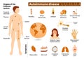 Autoimmune disease infographic Royalty Free Stock Photo