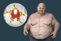 Autoimmune thyroiditis in obesity, conceptual 3D illustration showing an overweight patient and thyroid gland attacked by