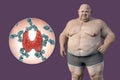 Autoimmune thyroiditis in obesity, conceptual 3D illustration showing an overweight patient and thyroid gland attacked by