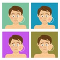 Avatar set for skincare infographic. Teenager boy with facial skin problems