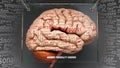 Avoidant personality disorder in human brain