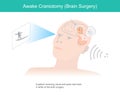 Awake craniotomy. A patient receiving visual and audio test brain