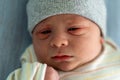Awake Newborn Baby Face Portrait Acne Allergic Irritations Early Days Grimace Crying On Blue Background. Child Start Royalty Free Stock Photo