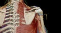 The axilla is the name given to an area that lies underneath the glenohumeral joint, at the junction of the upper limb and the