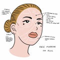 Face mapping for acne , beautiful woman face illustration