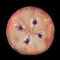 Babesia parasites inside red blood cell, the causative agent of babesiosis