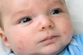 Baby Acne On Newborn Royalty Free Stock Photo