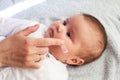 Baby with atopic dermatitis getting cream put. Care and Prevention Of Eczema Royalty Free Stock Photo