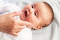 Baby with atopic dermatitis getting cream put. Care and Prevention Of Eczema Royalty Free Stock Photo