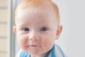 Baby boy with atopic dermatitis Royalty Free Stock Photo