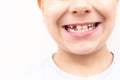 boy showing his lost milk tooth, close up Royalty Free Stock Photo