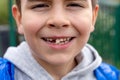 The baby boy smiling with wobbly milk tooth in open mouth. First molar teeth.