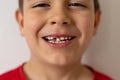 The baby boy smiling with wobbly milk tooth in open mouth. First molar teeth.