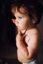 Baby with chicken pox Royalty Free Stock Photo