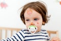 Face bruises and scratches Royalty Free Stock Photo