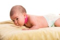 Baby girl with torticollis Royalty Free Stock Photo