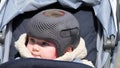 Baby girl wearing a cranial remoulding helmet flat head