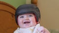 Baby girl wearing a cranial remoulding helmet flat head