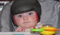 Baby girl wearing a cranial remoulding helmet flat head