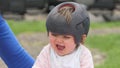 Baby girl wearing a cranial remoulding helmet flat head