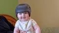 Baby girl wearing a cranial remoulding helmet flat head