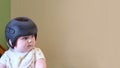 Baby girl wearing a cranial remoulding helmet flat head