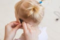 Baby girl wearing a hearing aid. Disabled child, disability and deafness concept. Royalty Free Stock Photo