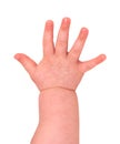 Baby hand