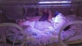 The baby lies in the incubator, with connected tube for nutricion. The baby moves his legs, side view Intensive care