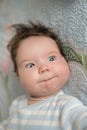 The baby`s eyes squint. Special problems with the baby s eyes. Myopia, astigmatism, cross-eyed Royalty Free Stock Photo