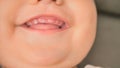 baby's mouth , the first small teeth