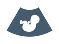 The Baby silhouette in ultrasound scan. Isolated Vector Illustration