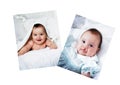 Baby Before and After Surgery Royalty Free Stock Photo