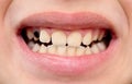 Baby teeth Royalty Free Stock Photo