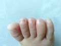 Baby toes with long dirty nails