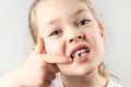 Baby tooth fell out. Portrait of small girl with a missing first tooth Royalty Free Stock Photo
