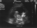 Baby UltraSound Royalty Free Stock Photo