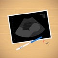 Baby ultrasound picture, pregnancy test on table Royalty Free Stock Photo